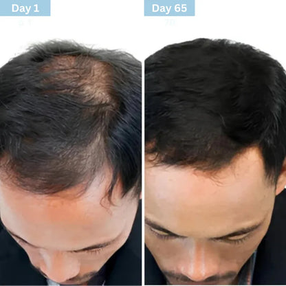 Daynava™ Roll-On for Hair Growth