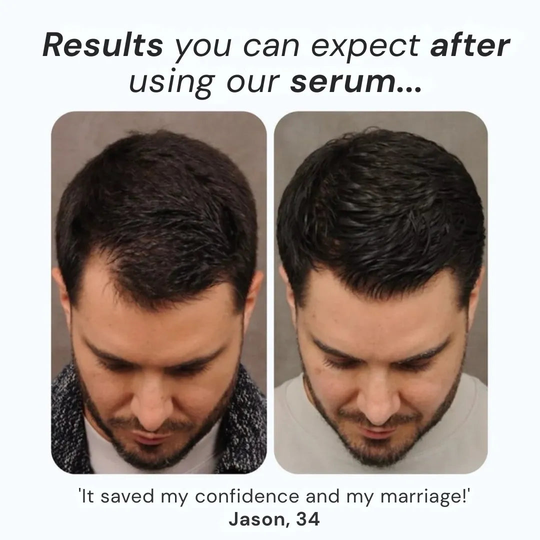Daynava™ Roll-On for Hair Growth