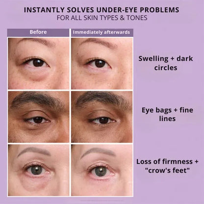 Daynava™ Instant Eye Lifter