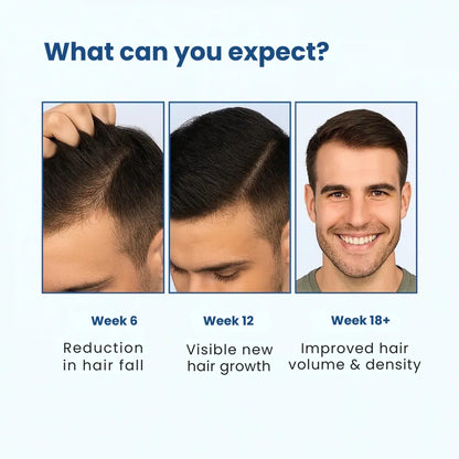 Daynava™ Roll-On for Hair Growth