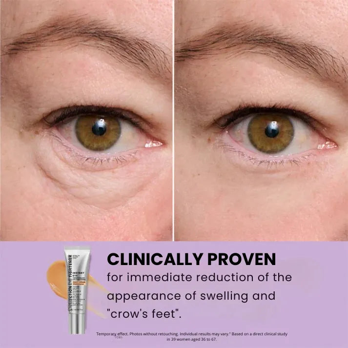 Daynava™ Instant Eye Lifter